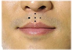 人中有痣代表什么（男人 女人）