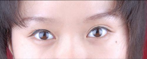 泪痣是哭出来的吗