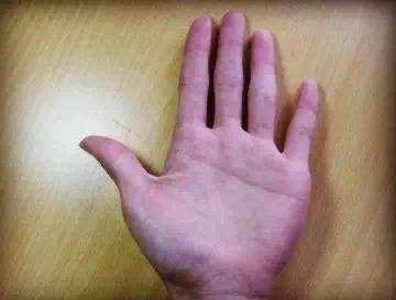 断掌是什么意思这(断掌命运好不好)