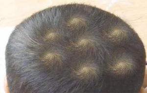 一旋二旋三旋有啥说法