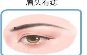 眉毛痣的位置与命运(图解)