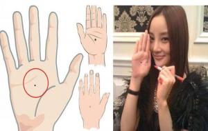 大富大贵痣长在哪里（天生暗藏痣）