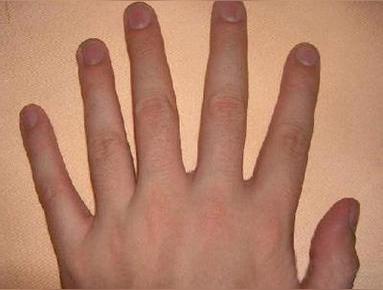 老人说六指天生是父母前世