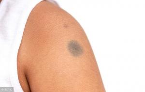 带胎记的孩子是来报恩的