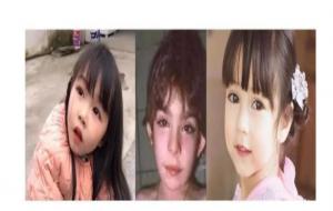 歌舞伎综合征为什么漂亮