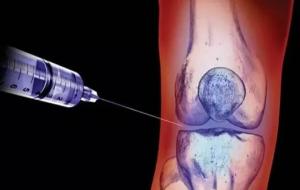 封闭针是什么意思(对身体有啥危害吗)