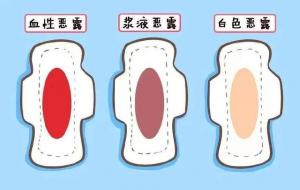 恶露是什么样子的图片