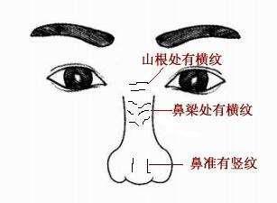 鼻子上有横纹、竖纹面相代表什么