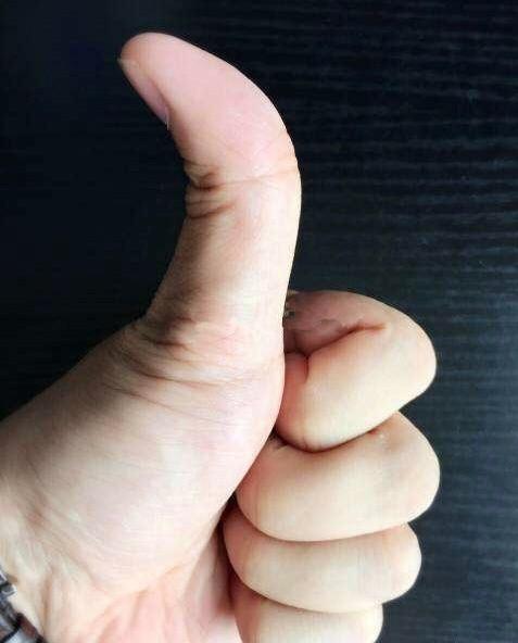 大拇指向后弯曲代表什么