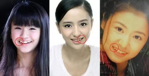 八重齿的男人、女人命运