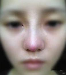 蒜头鼻女人什么命运(面相好吗)