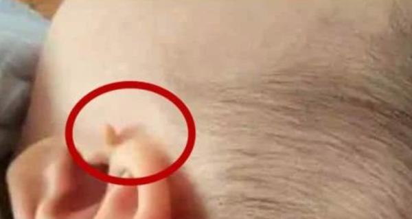 拴马桩耳朵有什么寓意