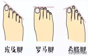 埃及脚、罗马脚、希腊脚的命运