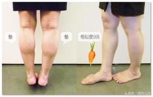 萝卜腿是什么腿型