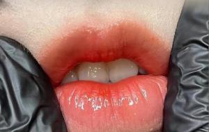 纹唇的好处和坏处(纹唇优点与缺点)