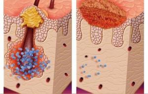 一周不洗脸为什么皮肤变好了