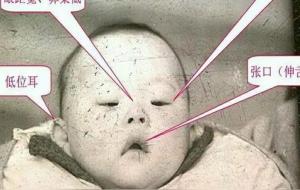 xy染色体是男是女