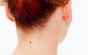 脖子前或后有痣的人好不好呢