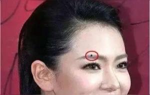 身上有暗财痣的人,偏财运好