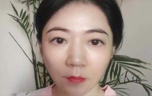 什么人适合整容,整容能改命?