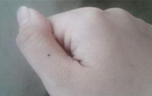 身上长痣的人是和佛家有缘的