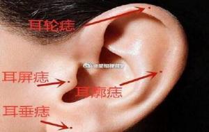 耳痣的位置与命运图解